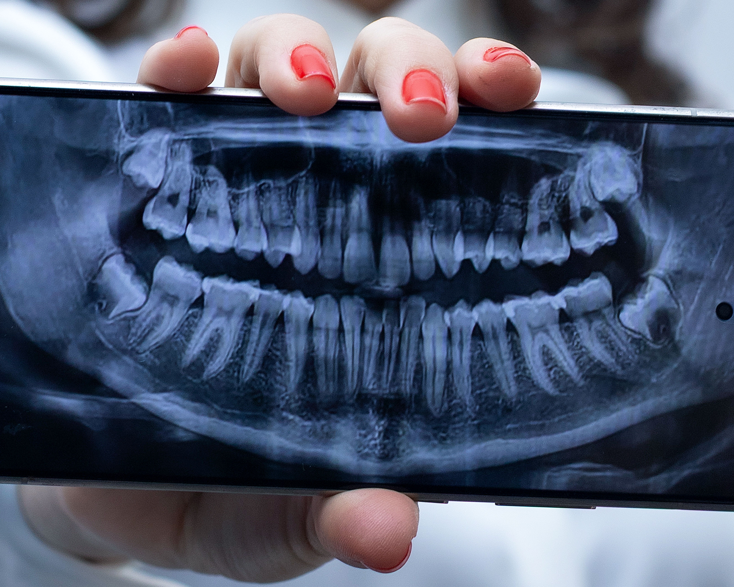 Radiografía dental