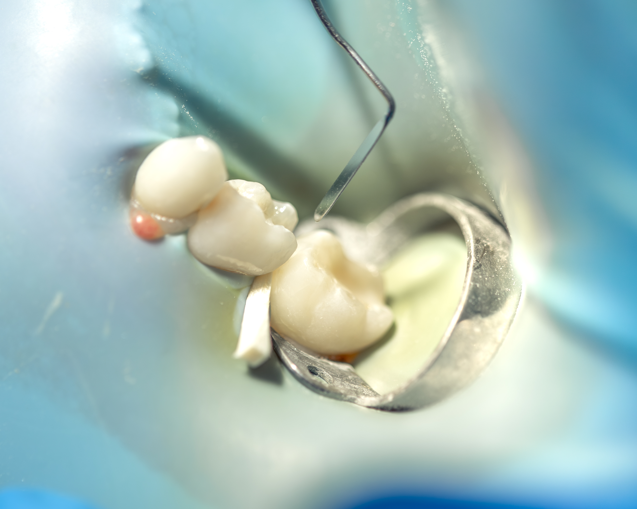 Endodoncia