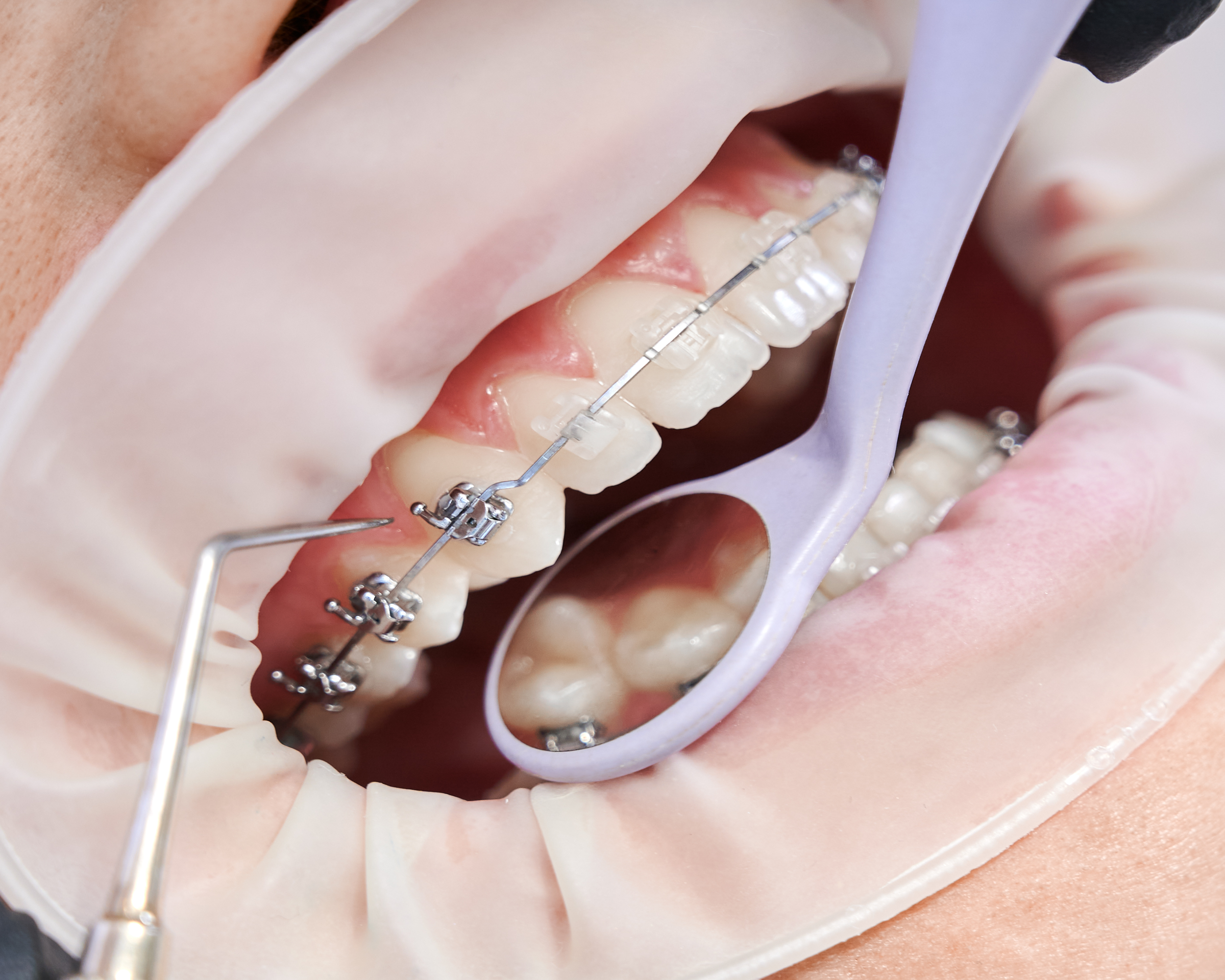 Ortodoncia Dental